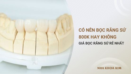 Có nên bọc răng sứ 800k không? Răng sứ rẻ nhất giá bao nhiêu?