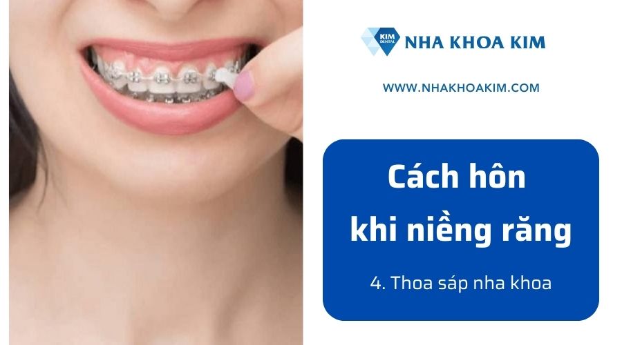 Sử dụng sáp nha khoa khi niềng răng