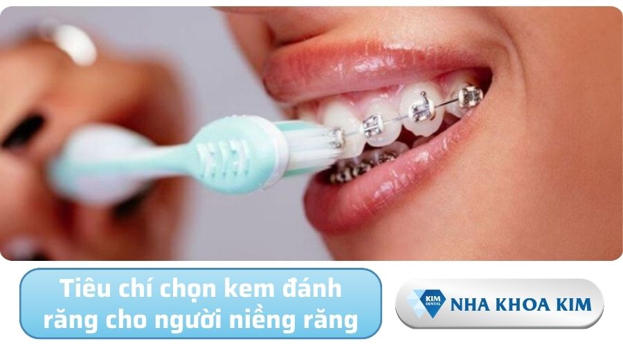 Niềng răng nên dùng kem đánh răng nào?