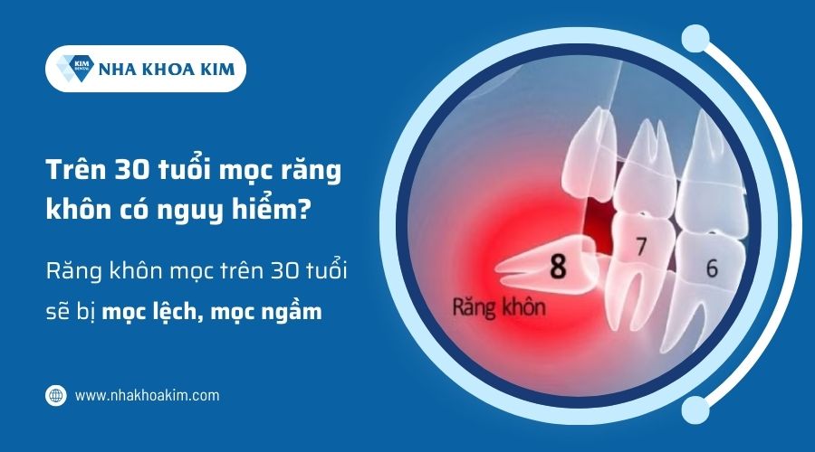 Trên 30 tuổi mọc răng khôn có nguy hiểm không?