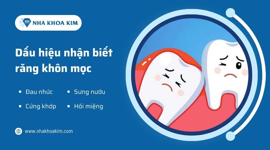 Làm sao để biết mình đang mọc răng khôn?