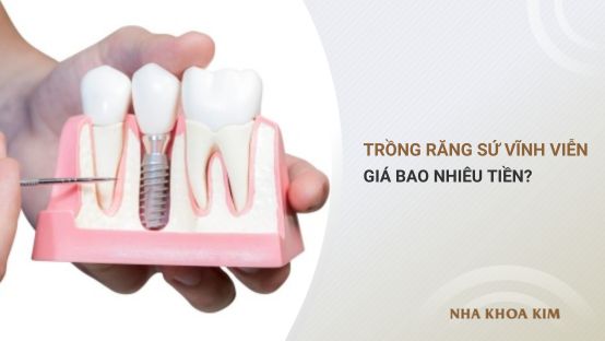 Chi phí trồng răng sứ vĩnh viễn giá bao nhiêu tiền?