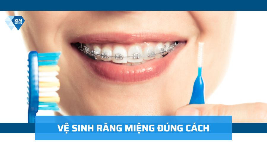 Vệ sinh răng niềng đúng cách