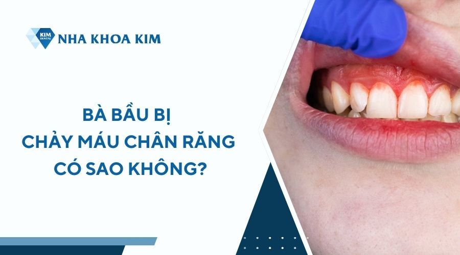 Bà bầu bị chảy máu chân răng có sao không?