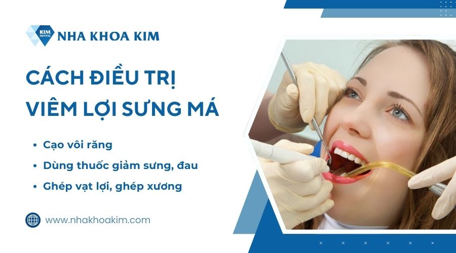 Cách điều trị viêm lợi sưng má
