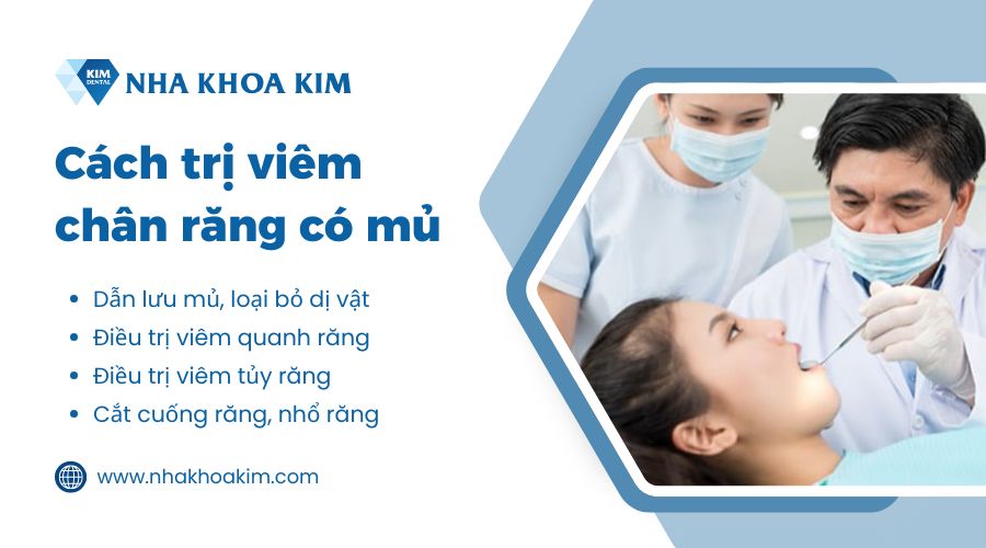 Cách trị viêm chân răng có mủ