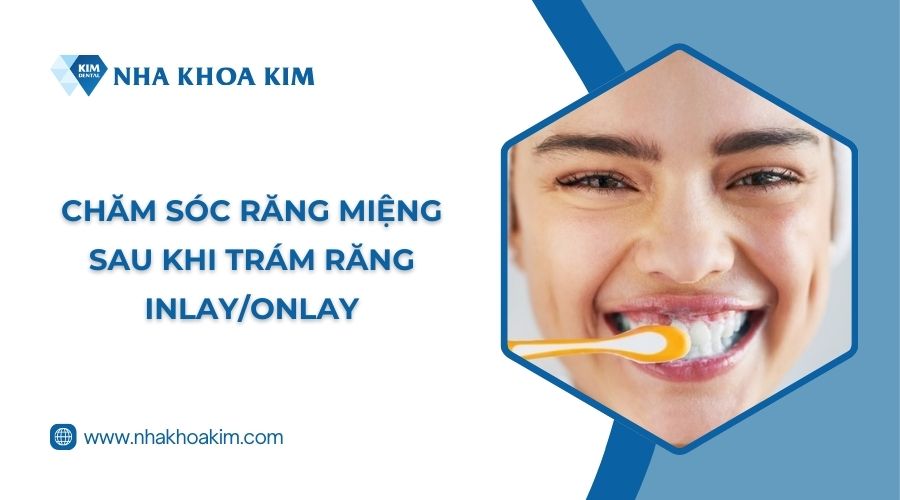 Chăm sóc răng miệng sau khi trám Inlay/Onlay