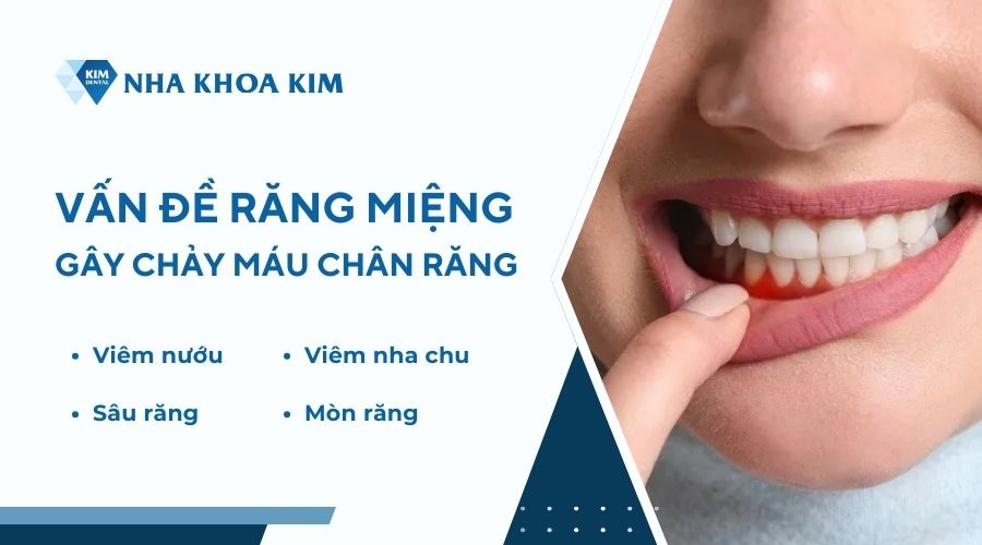 Bà bầu hay bị chảy máu chân răng là bệnh gì