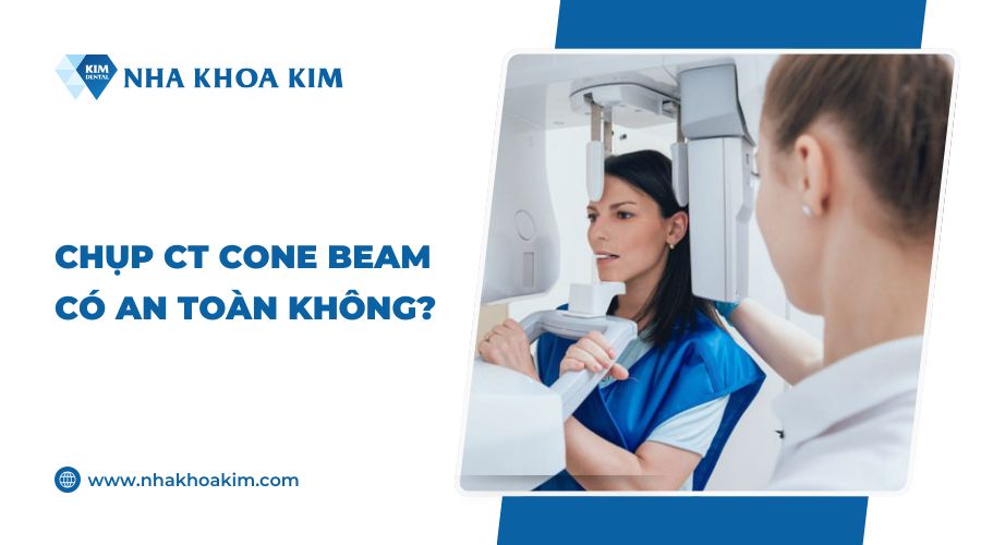 Chụp CT Cone Beam có an toàn không?