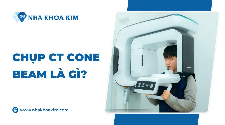 Chụp CT Cone Beam là gì?