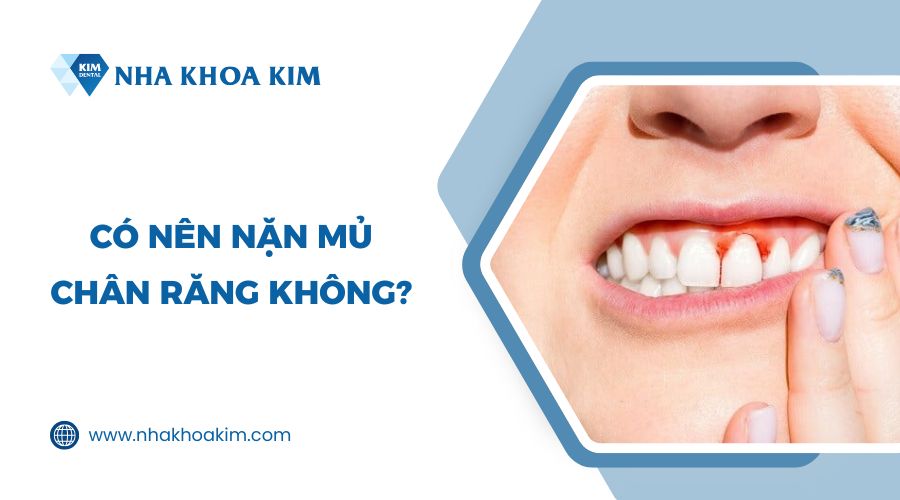 Có nên nặn mủ chân răng không?