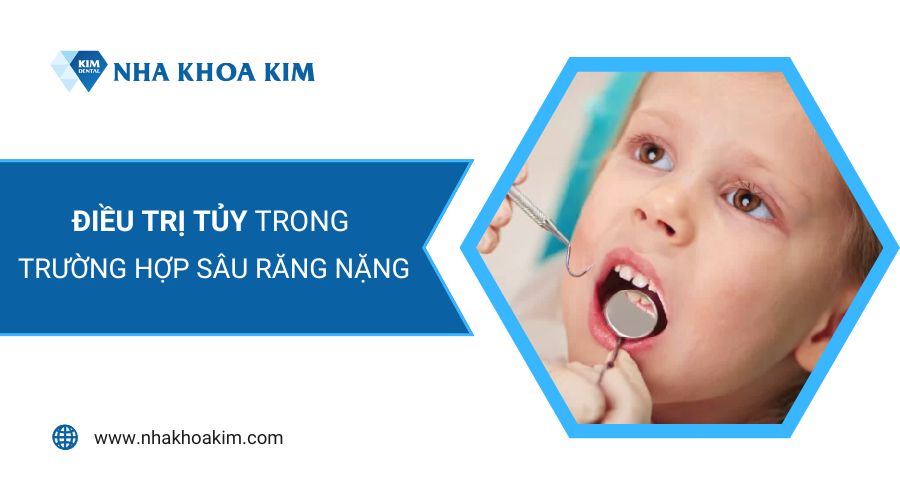 Trẻ ăn kẹo sâu răng điều trị như thế nào?