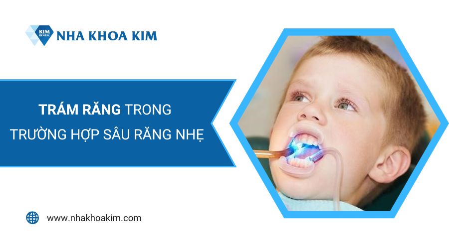 Cách điều trị sâu răng nhẹ do ăn kẹo ở trẻ nhỏ