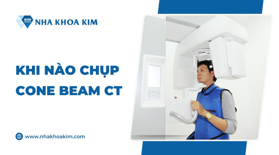 Khi nào cần chụp Cone Beam CT?