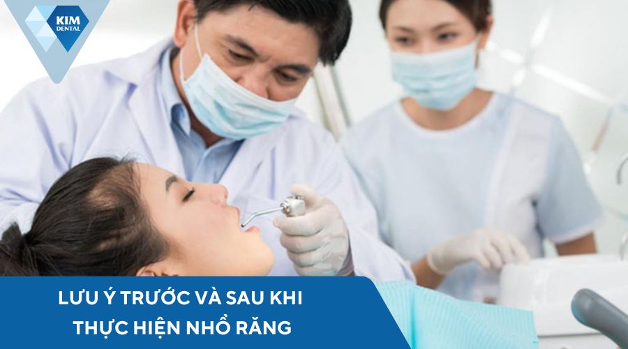 Những lưu ý khi thực hiện nhổ răng
