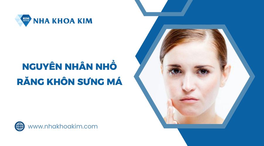 Tại sao nhổ răng khôn bị sưng má?