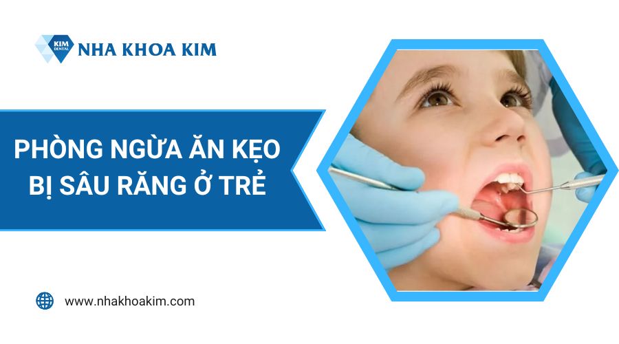 Cách phòng ngừa ăn kẹo bị sâu răng ở trẻ