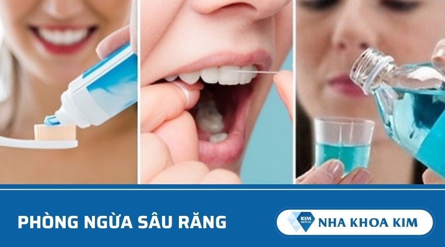 Cách phòng ngừa sâu răng