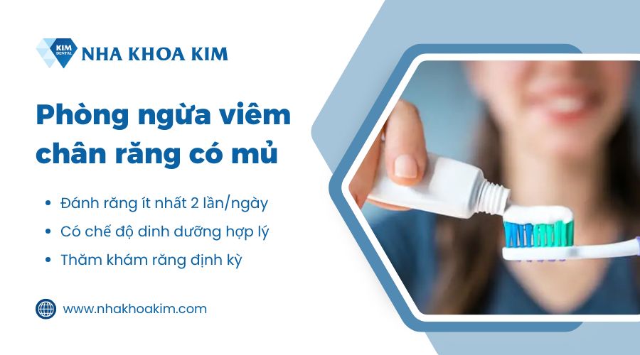 Cách phòng ngừa viêm chân răng có mủ