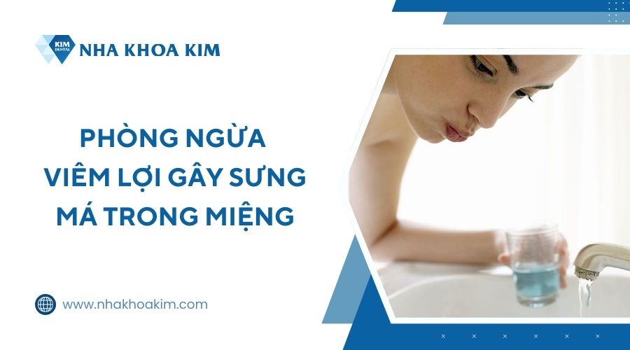 Cách phòng ngừa viêm lợi gây sưng má trong miệng 