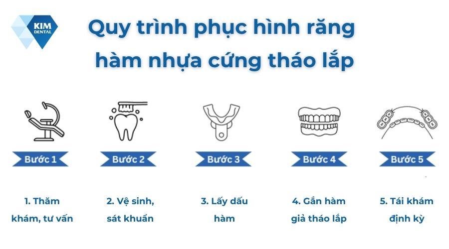 Quy trình phục hình răng hàm nhựa cứng tháo lắp