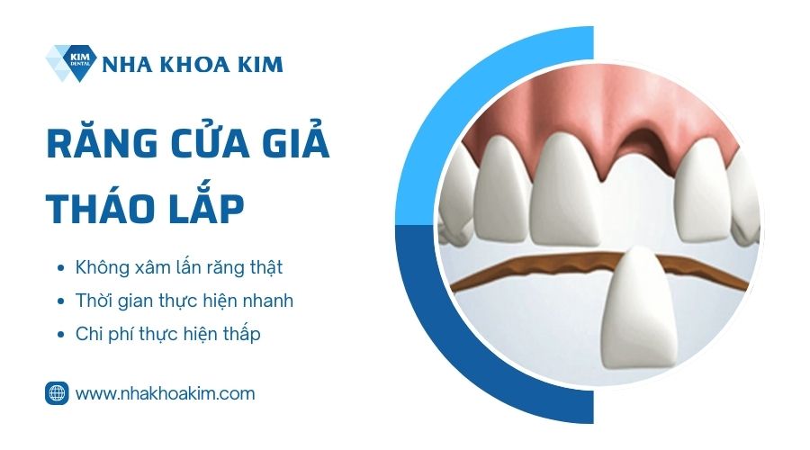 Răng cửa giả tháo lắp