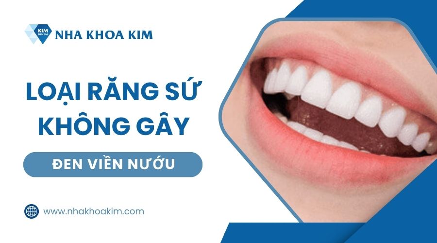 Các loại răng sứ không gây đen viền nướu