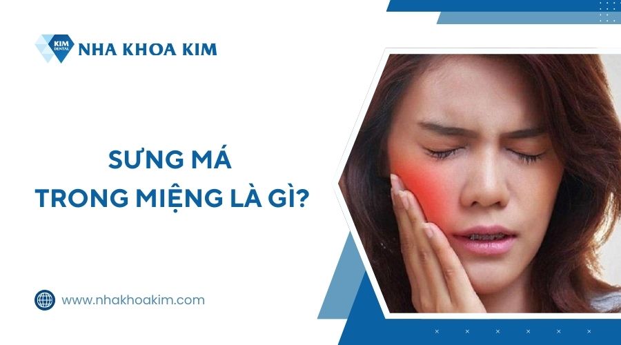 Sưng má trong miệng là gì?
