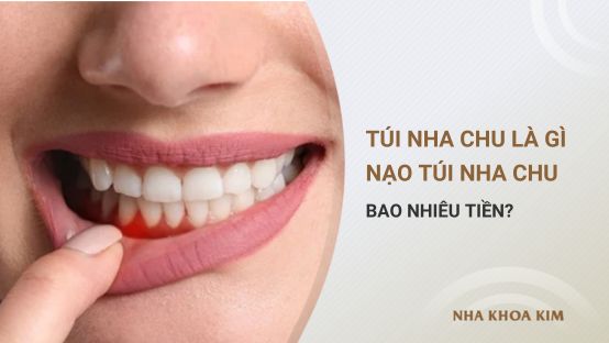 Túi nha chu là gì? Nạo túi nha chu bao nhiêu tiền