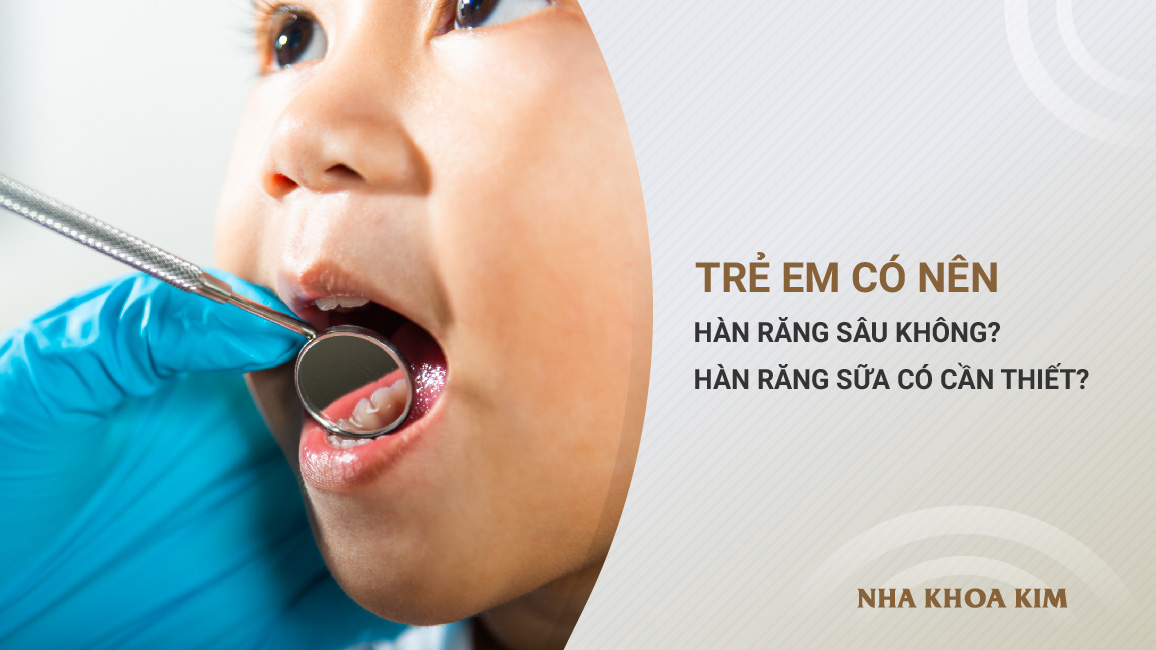 Trẻ em có nên hàn răng sữa bị sâu không?