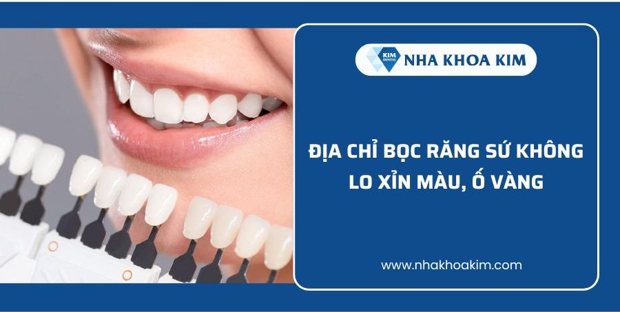 Địa chỉ bọc răng sứ không lo xỉn màu tại nha khoa kim