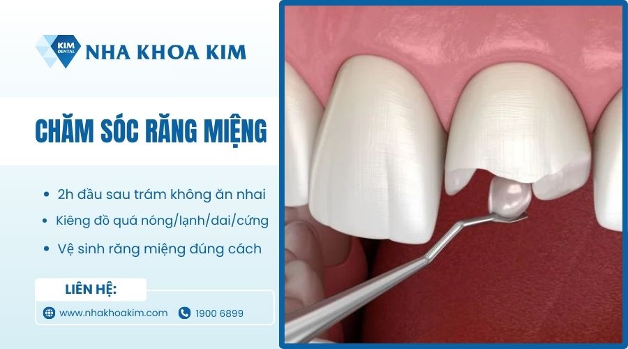 chăm cóc răng miệng