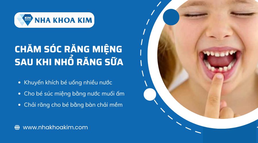 Lưu ý chăm sóc răng miệng sau khi nhổ răng sữa 