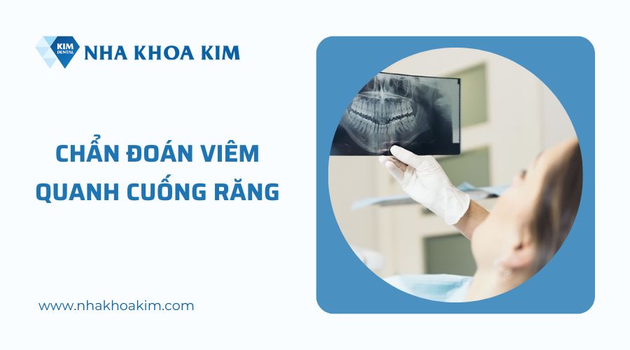 chẩn đoán viêm quanh cuống răng