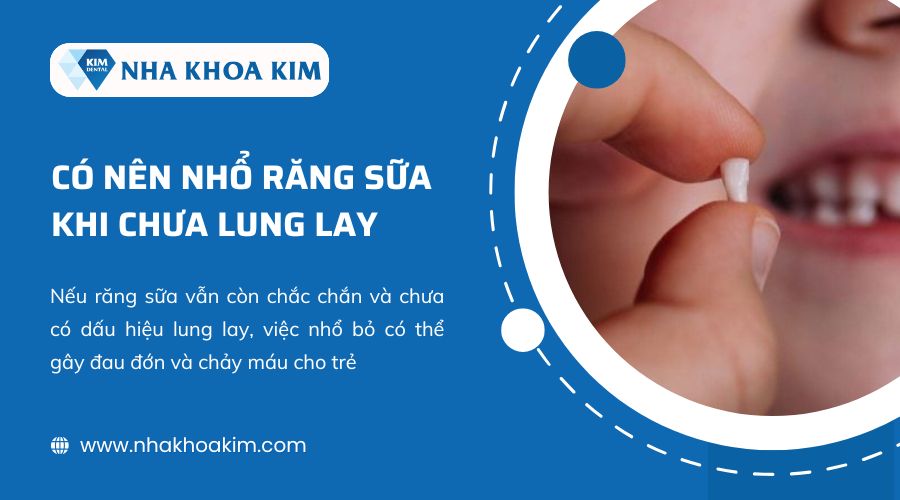 Có nên nhổ răng sữa khi chưa lung lay?
