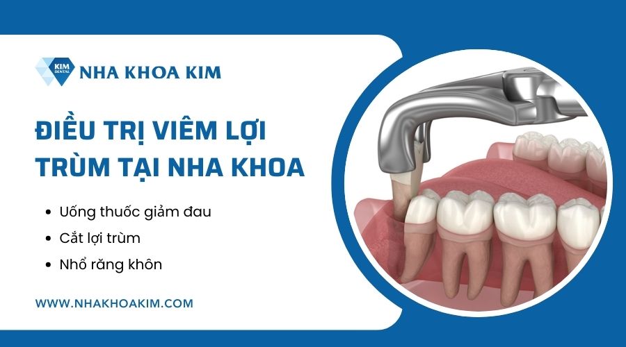 Cách trị viêm lợi trùm