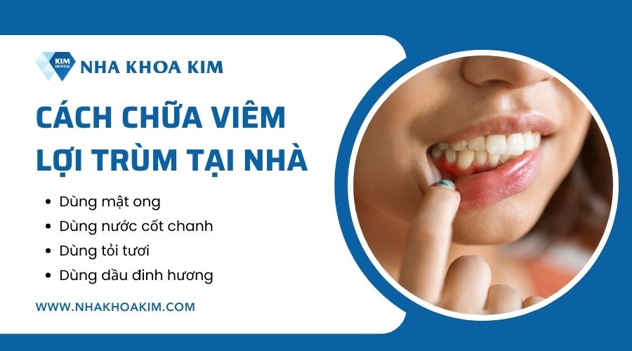 Cách chữa viêm lợi trùm tại nhà