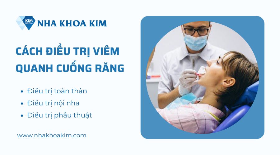 cách điều trị viêm quanh cuống răng