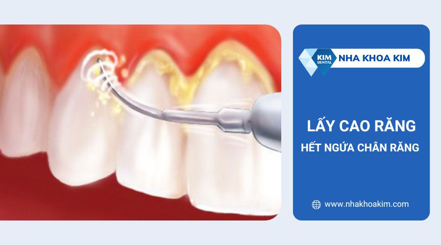 Làm thế nào hết ngứa chân răng?