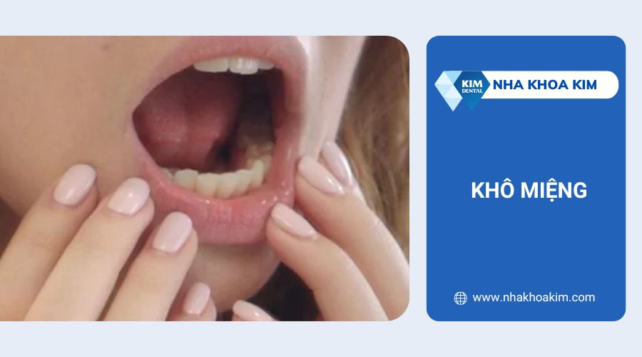 Ngứa chân răng do khô miệng