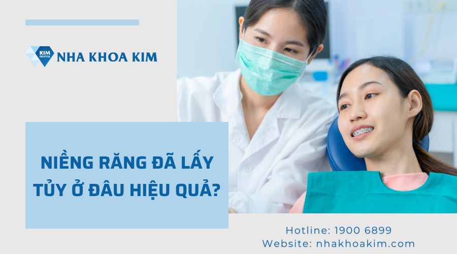 niềng răng đã ấy tủy uy tín tại Nha Khoa Kim