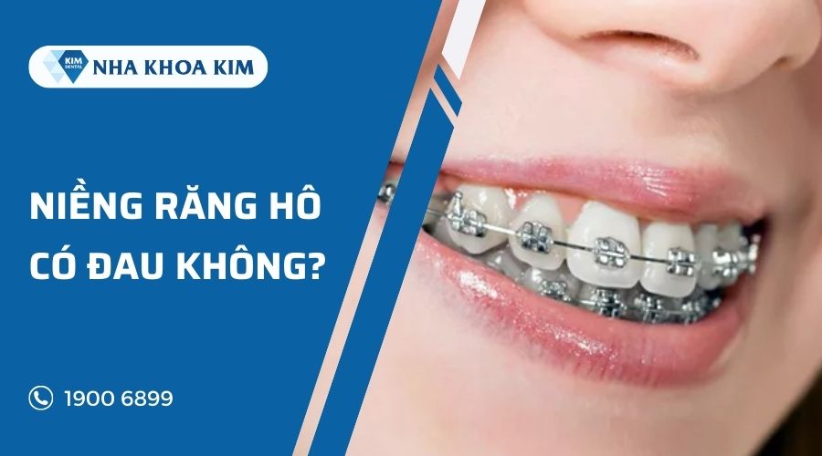 niềng răng hô có đau không