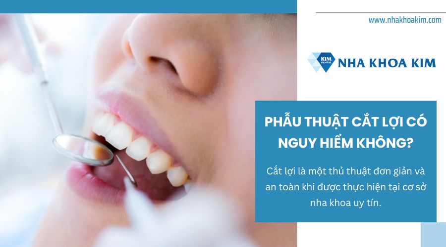 Cắt lợi có nguy hiểm không?