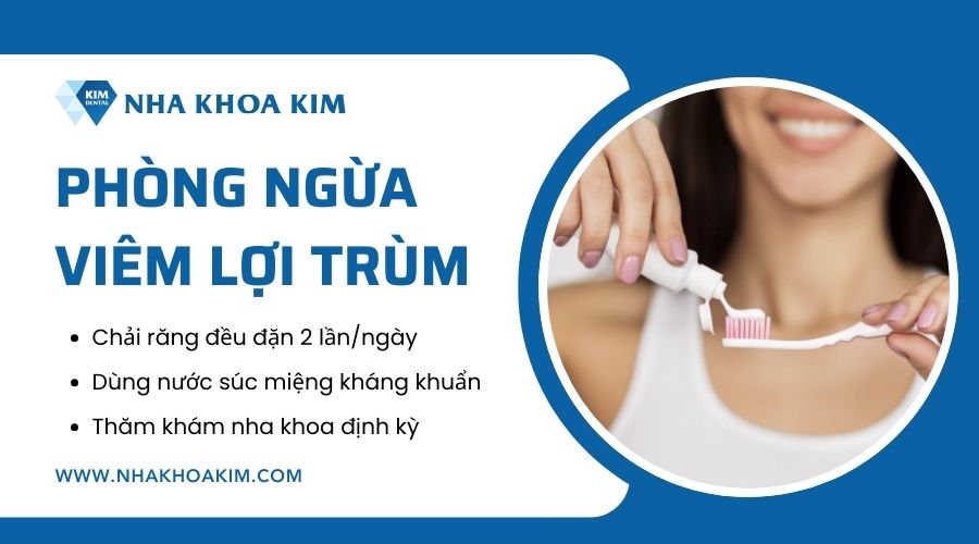 Biện pháp phòng ngừa viêm lợi trùm