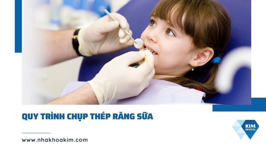 Quy trình chụp thép răng sữa