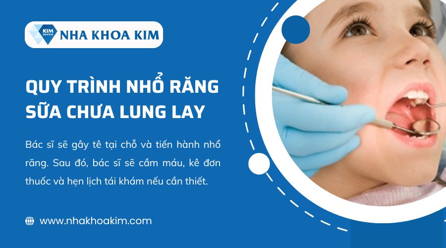 Quy trình nhổ răng sữa chưa lung lay 