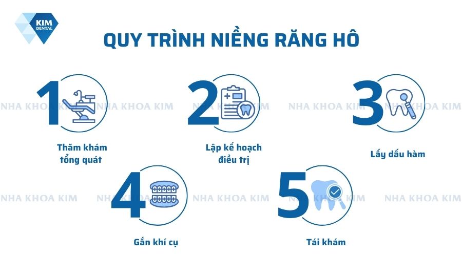5 quy trình niềng răng hô