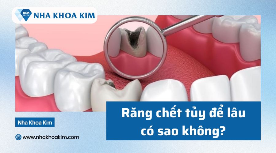 Răng chết tủy để lâu có sao không?