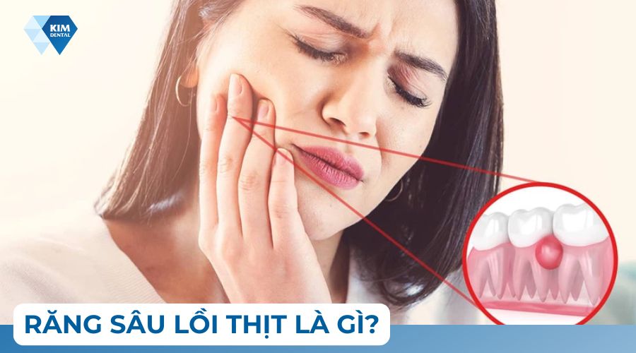 răng sâu lồi thịt là gì
