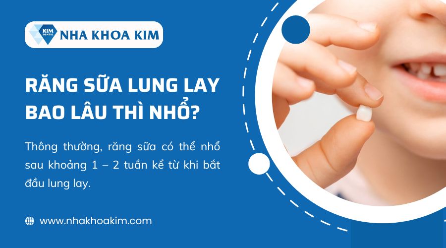 Răng sữa lung lay bao lâu thì nhổ?